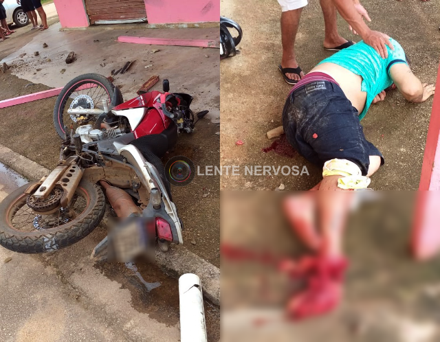 Motociclista fica inconsciente e tem pé dilacerado em gravíssimo acidente no Bairro Cidade Nova - VÍDEO