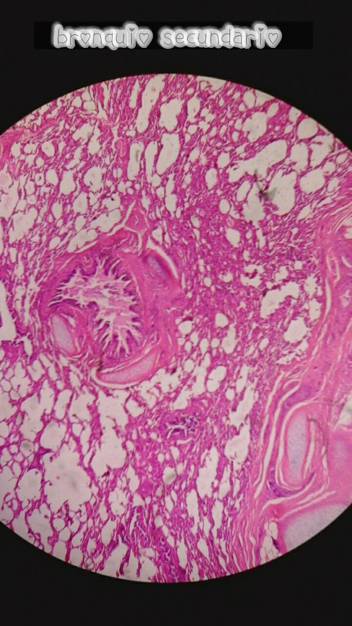 Placas de histología : Sistema respiratorio: Pulmón