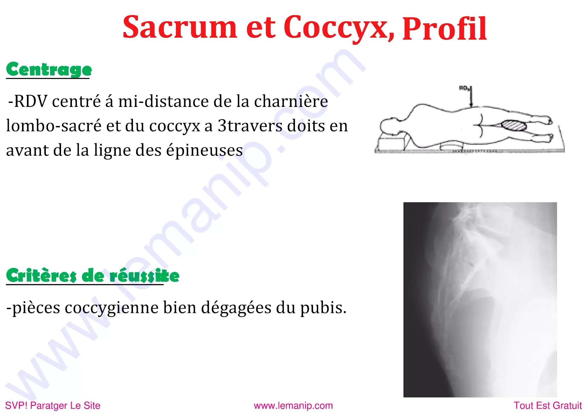 Sacrum et Coccyx de profil