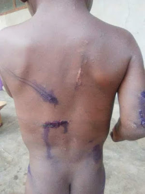 2 Photos: See what a heartless father did to his 3-year-old child for defecating in the bedroom