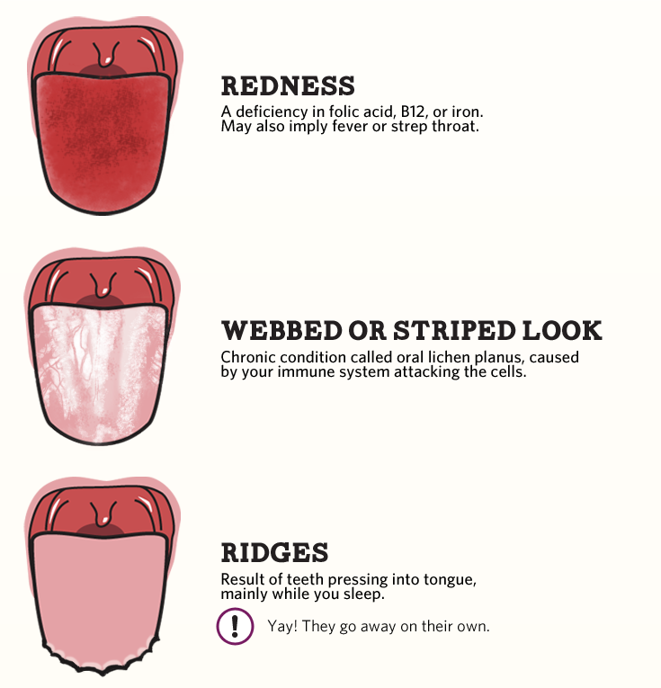 In Case You Missed Infographic What Does Your Tongue Say About Your Health?
