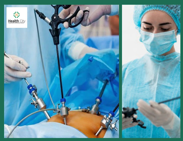 Laproscopic Surgery in Lucknow