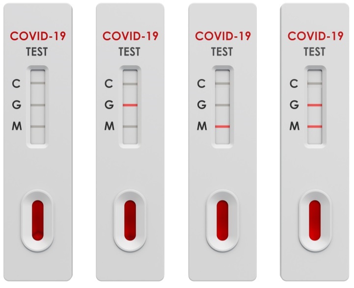 Экспресс-тест на коронавирус covid-19. Экспресс тест как выглядит результат. Экспресс тест как выглядит результат. Результаты экспресс теста. Экспресс тест на коронавирус.