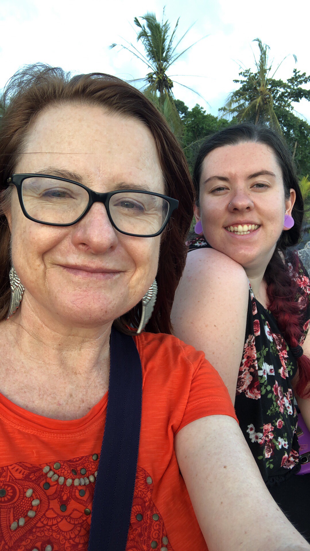 Melanoma Back to life after stage IV melanoma What do you wear for a