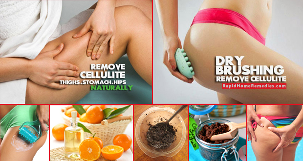How To Get Rid Of Cellulite On Stomach Naturally How To Get Rid Of Cellulite On Stomach Naturally