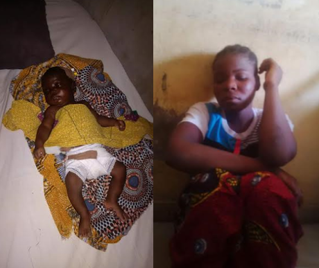 88 9-month-old baby boy whose genital was cut off by his stepmother, undergoes first corrective surgery in Niger State