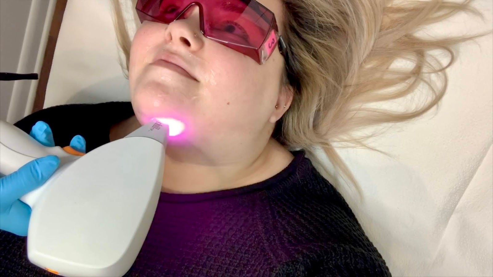 Chicago Plus Size Petite Fashion Blogger Natalie in the City gets laser hair removal on her lip and chin at SpaDerma med spa in Chicago.