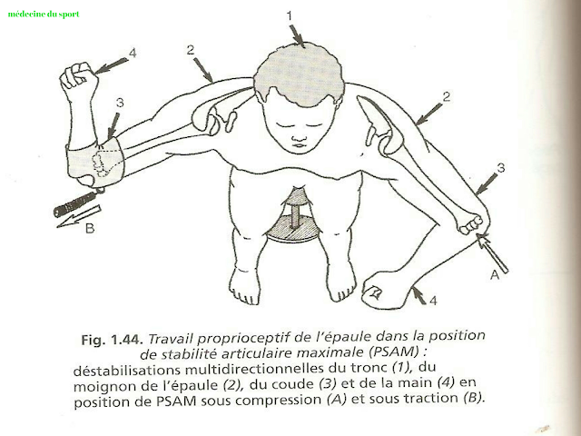 Rééducation de la luxation de l'epaule