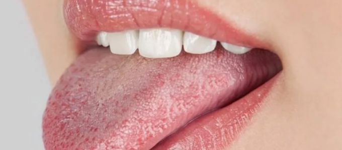 Τι αποκαλύπτει η γλώσσα σας για την υγεία σας - Τα σημάδια που πρέπει να σας ανησυχήσουν 