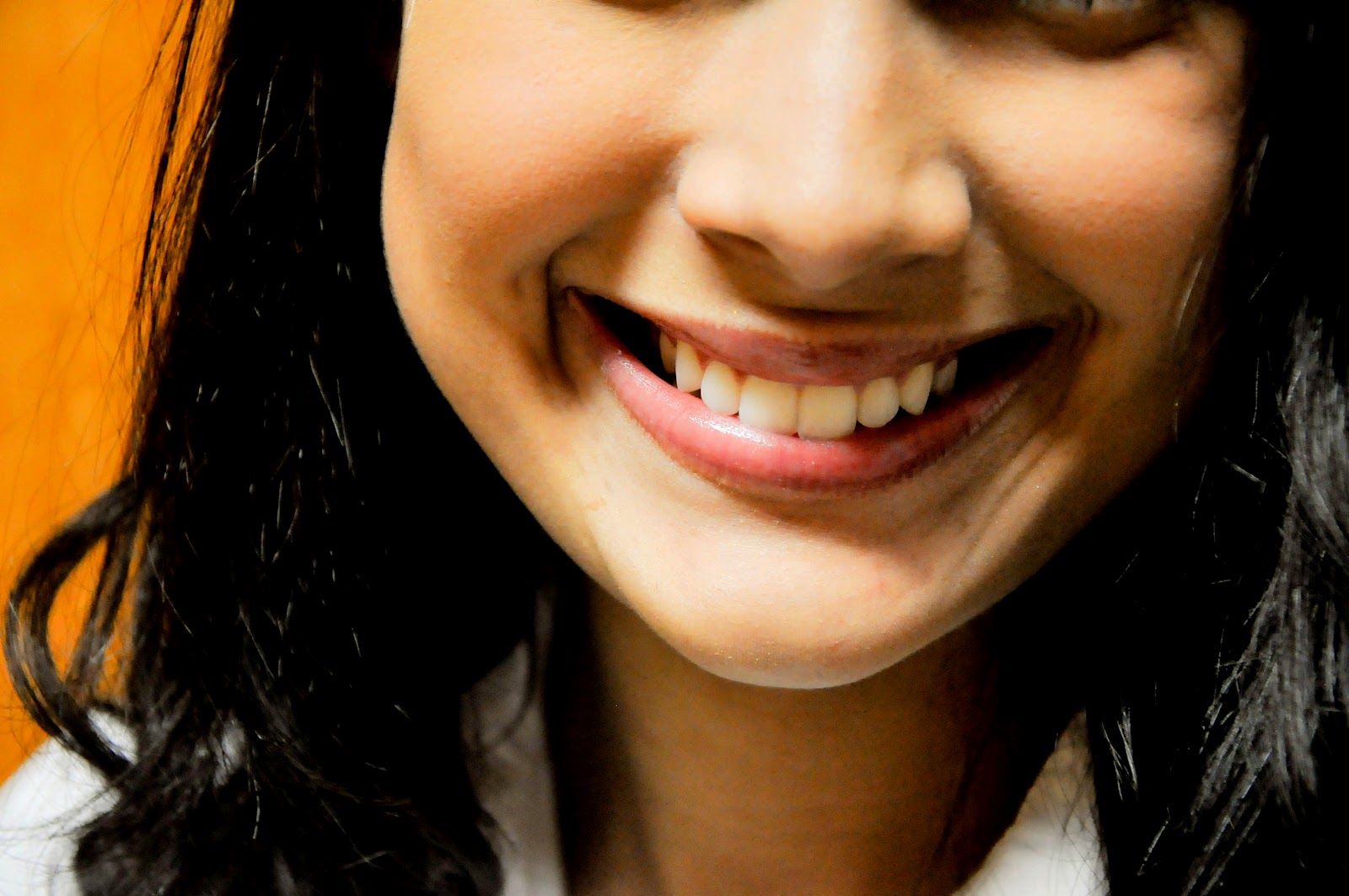 Sonhar Com Dente Amarelo De Outra Pessoa ABJ Notícias: Dentes amarelados podem afetar a autoestima