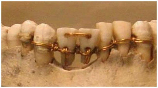 Лечение зубов. История медицины Древнего Египета