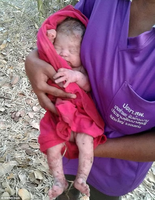 Kejam! Bayi Ini Ditusuk 14 Kali dan Dikubur Hidup-Hidup, Ditemukan Masih Hidup Keadaanya Miris Kejam! Bayi Ini Ditusuk 14 Kali dan Dikubur Hidup-Hidup, Ditemukan Masih Hidup Keadaanya Miris