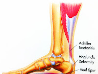 Foot Tendon Diagram Foot Tendon Diagram