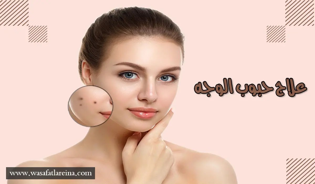 افضل الوصفات الطبيعية لعلاج حبوب الوجه