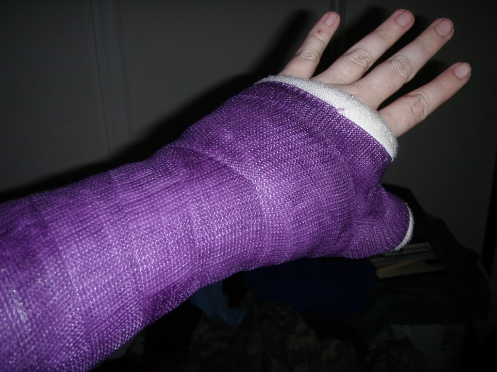 PTCaster SATC (Short Arm Thumb Cast)