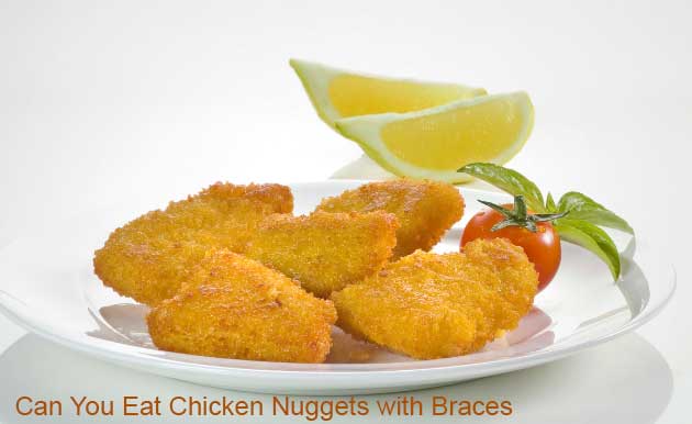 can-you-eat-chicken-nuggets-with-braces