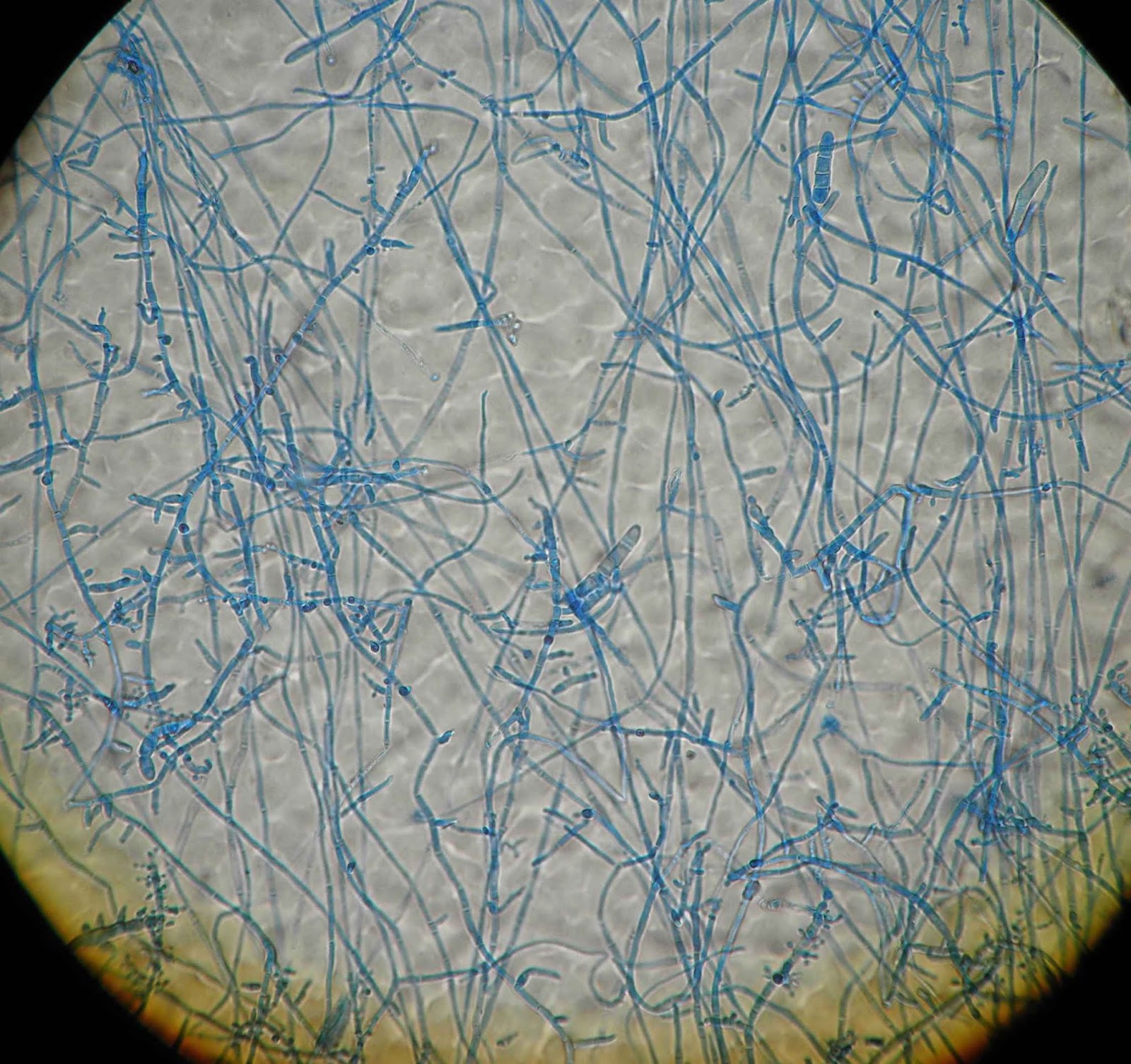 ATLAS MICOLOGIA TRICHOPHYTON INTERDIGITALE