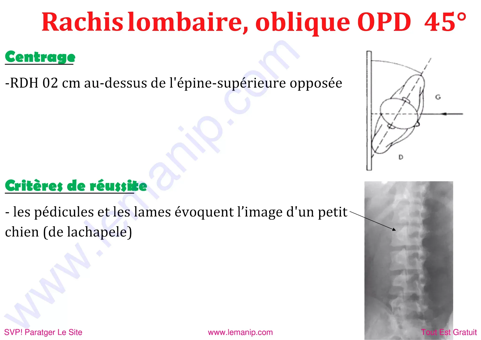 Rachis lombaire oblique