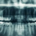 20 Tanya Jawab tentang Gigi, sakit gigi, ronsen gigi, dokter gigi