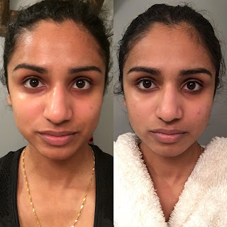 Full face before and after use of Olly Vitamin