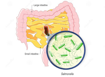 Eliminar bacterias intestinales