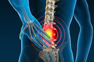 BACK PAIN ( CAUSES OF LOW BACK PAIN)