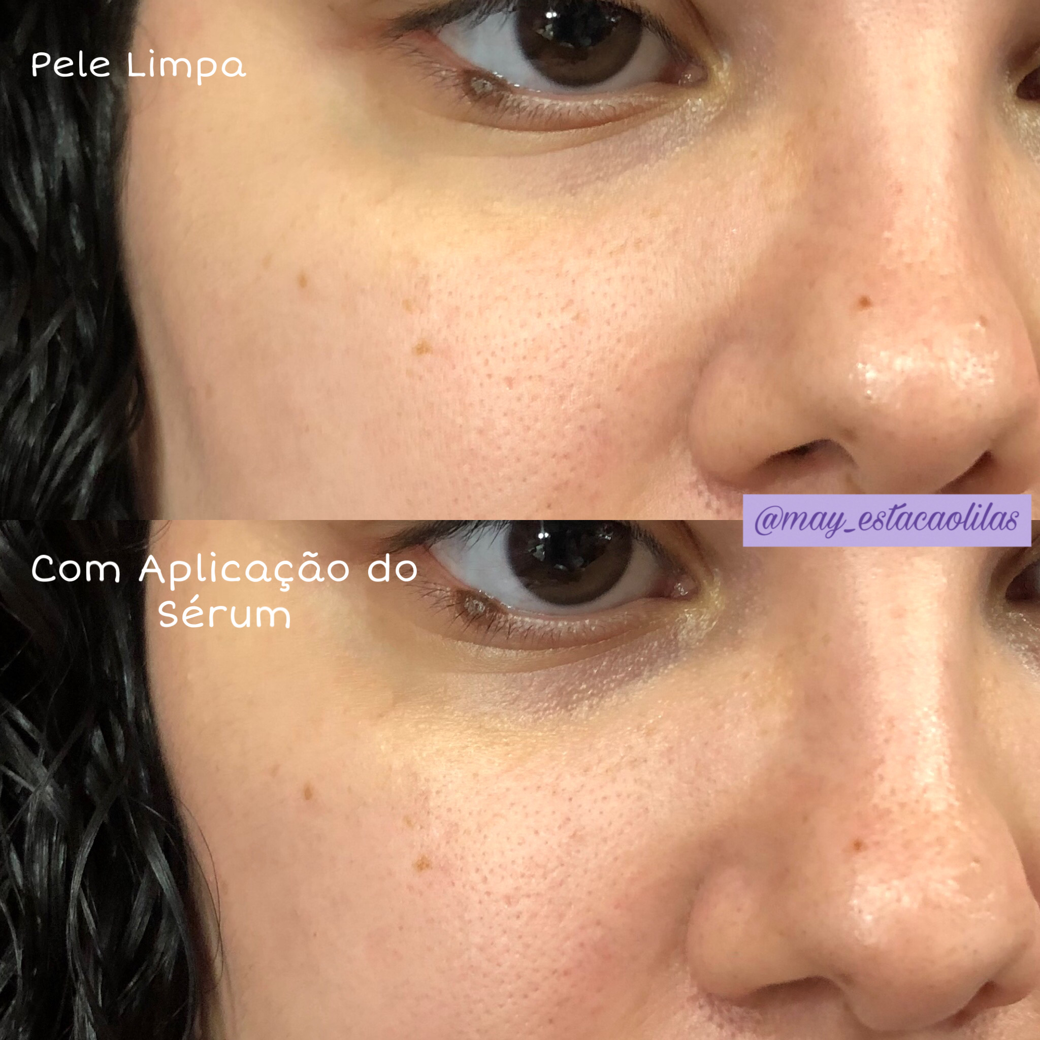 Estação Lilás Testando Sérum Hyalu B5 Repair da La RochePosay