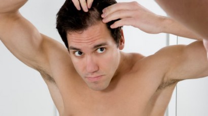 Male Pattern Baldness - Hair Loss Info