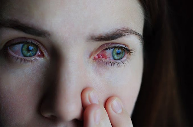 Brûlure et rougeur dans ses yeux? Des symptômes qu'on ne doit JAMAIS lâcher