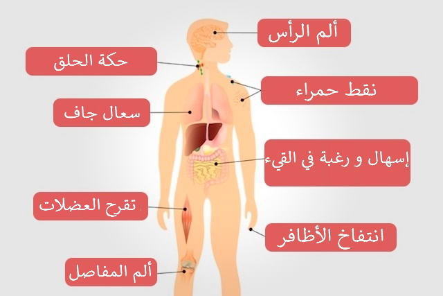 متى تظهر أعراض الإيدز