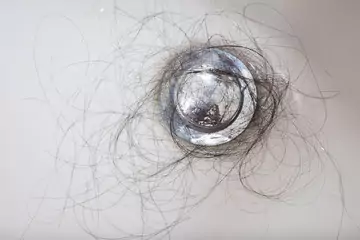 How Much Hair Loss Is Normal? How Much Hair Loss Is Normal?