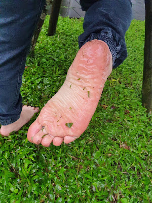 赤腳走路 預防疾病