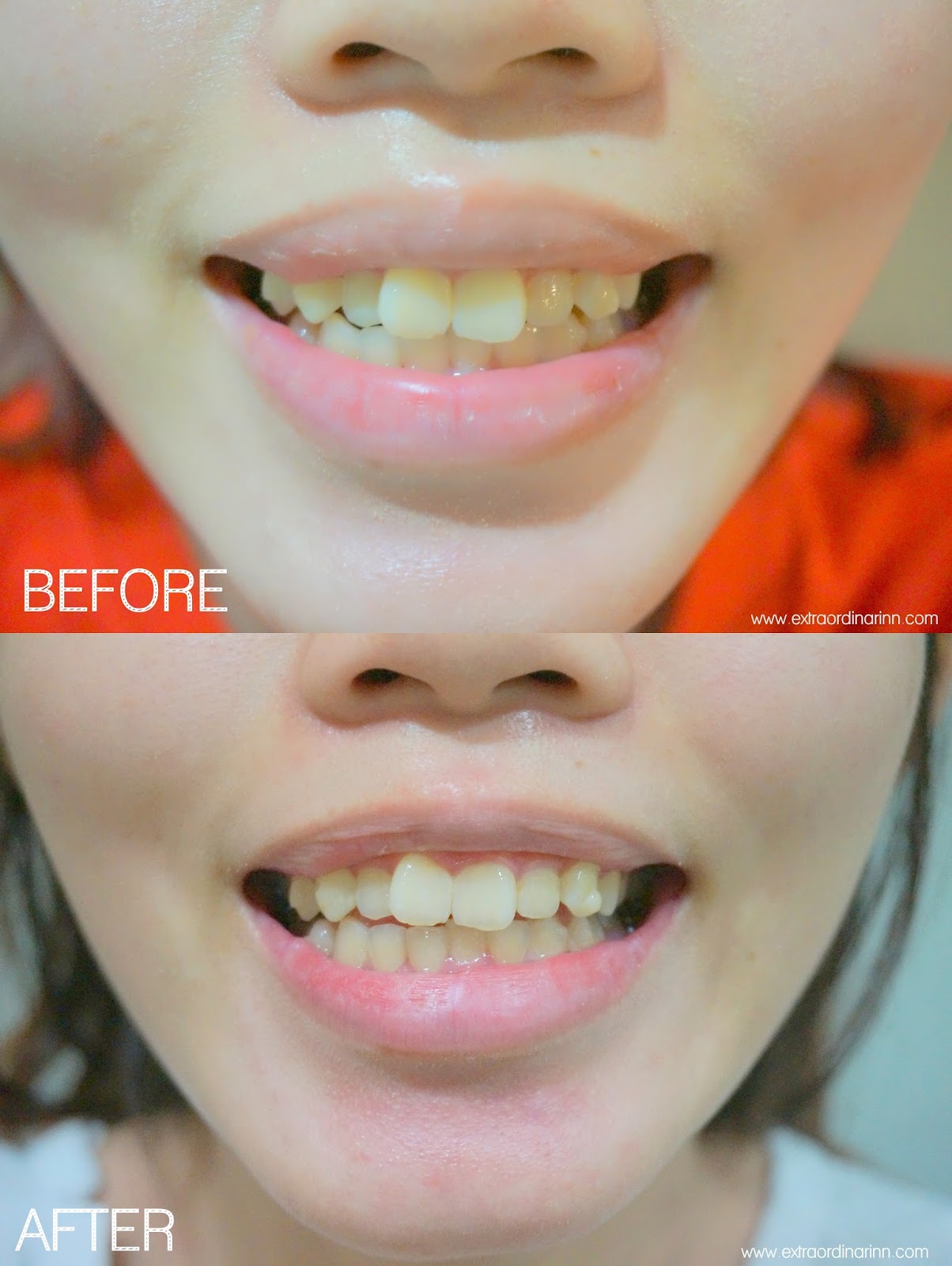 Carinn; carerynn Malaysia Fashion, Beauty & Lifestyle Blog Carinn x