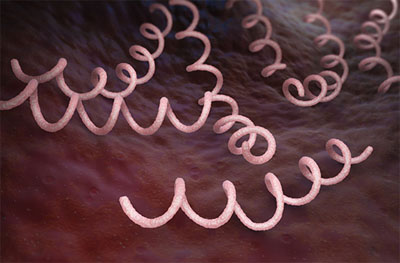 Bakteri treponema pallidum menyebabkan penyakit kelamin disebut