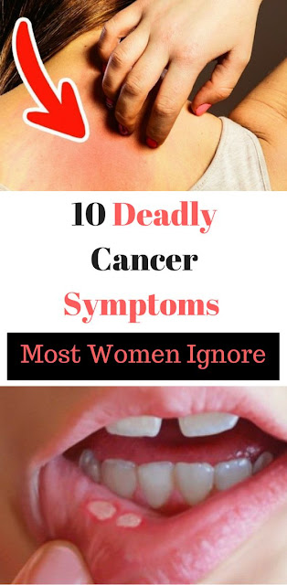 10 Most Reasonable Cancer Symptoms That Every Women Ignore