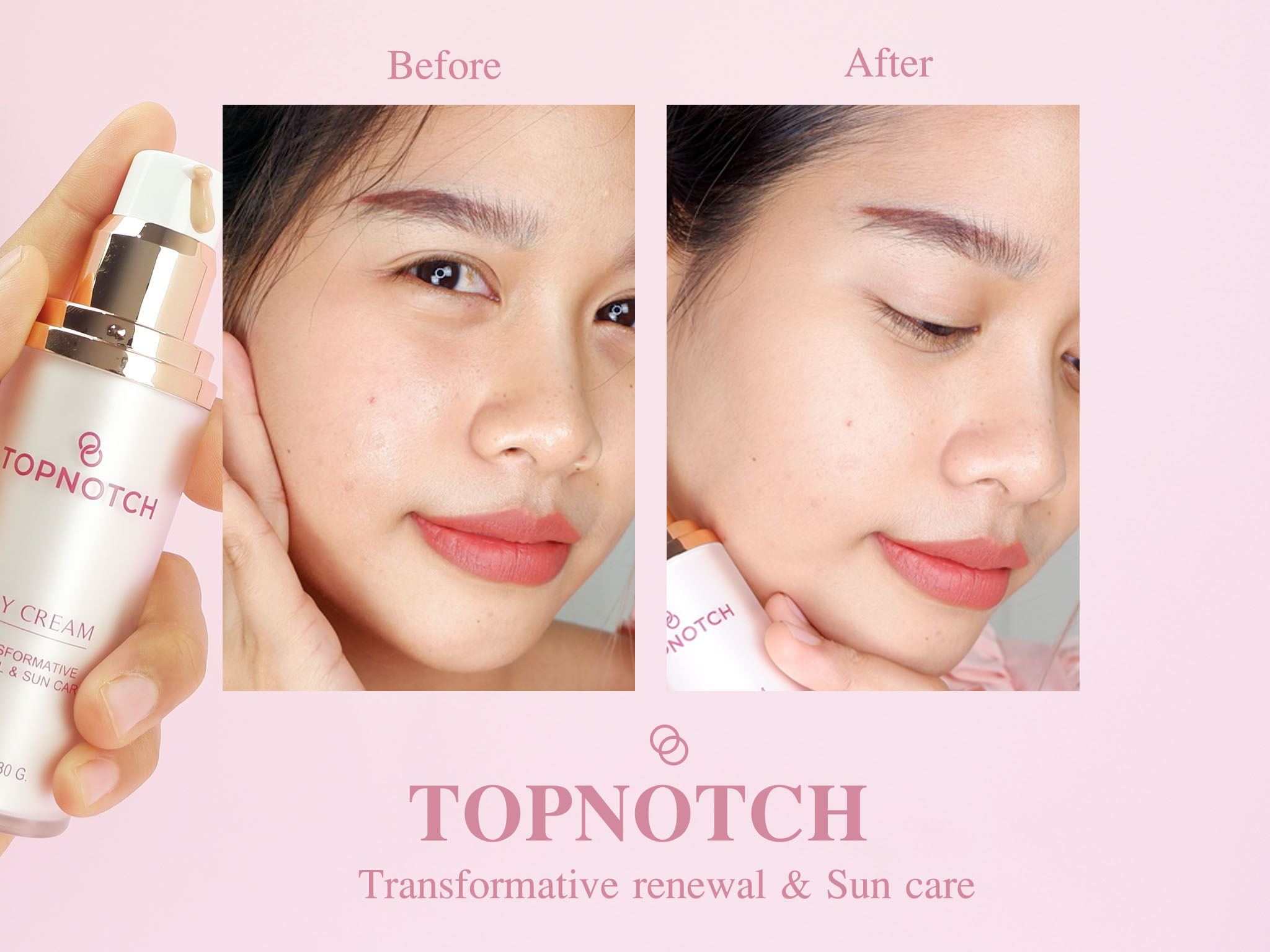 TOPNOTCH สกินแคร์กู้ผิวสำหรับผิวบอบบางแพ้ง่าย เพื่อผิวดูกระจ่างใส ไร้