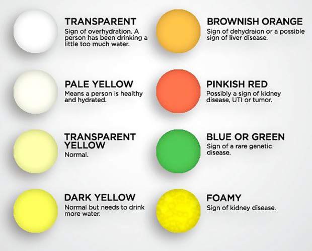 What The Color Of Your Urine Says About Your Health!!!