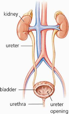 Urinary tract infection 1