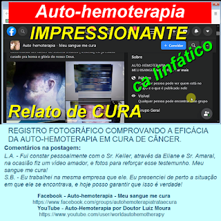 IMPRESSIONANTE TESTEMUNHO DE CURA PELA AUTO-HEMOTERAPIA - cancer do sistema linfático (linfoma)