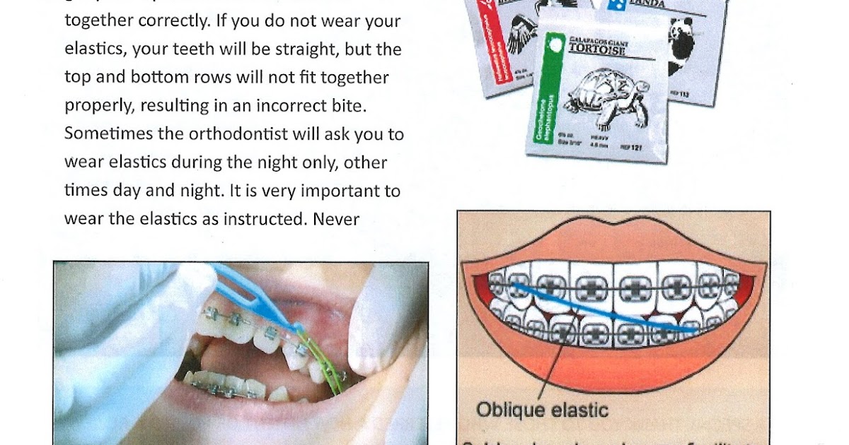 Embracing Innovative Orthodontics Portage, Kalamazoo, Paw Paw, MI