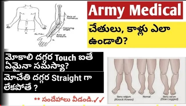 Indian Army Rally Medical exam information