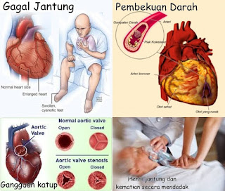 Cara Mengobati Penyakit Jantung Lemah Secara Efektif Dan Cepat Sampai Tuntas