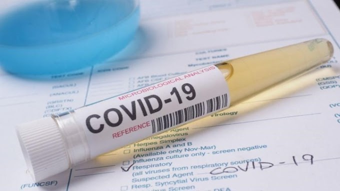 Κορονοϊός: Νέα μέτρα για να μην «μείνουμε σπίτι» - Κρίσιμη η εβδομάδα για την Αττική