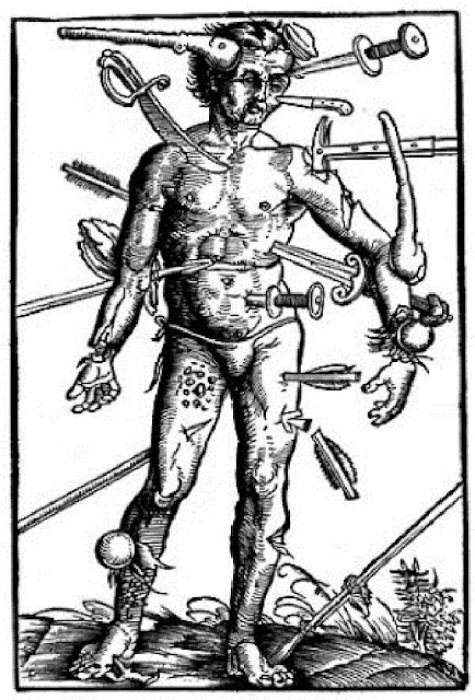 Иллюстрация из работы фон Герсдорфа,  демонстрирующая многообразие ранений