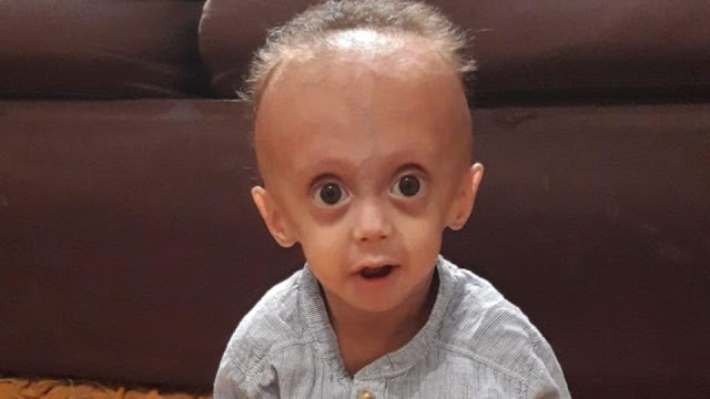 كيفية علاج هذا المرض؟ كيفية علاج هذا المرض؟