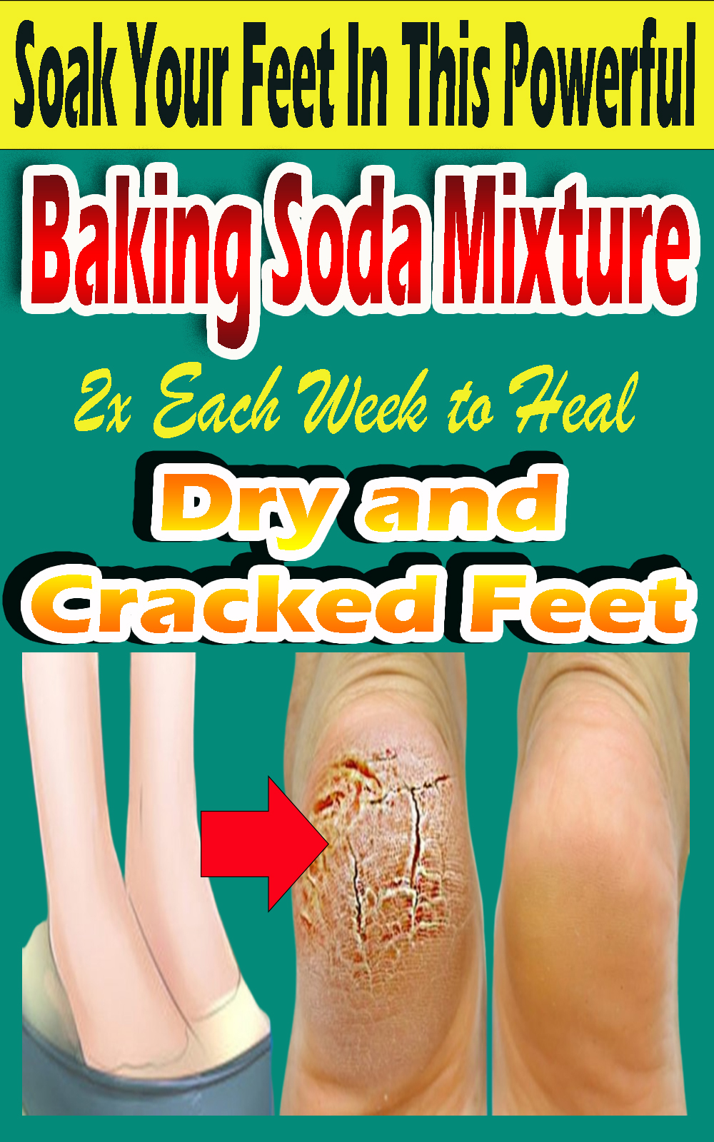 Soak Your Feet In This Powerful Baking Soda2x Each Week to Heal Dry and