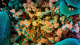 Virus dilihat bawah elektron mikroskop