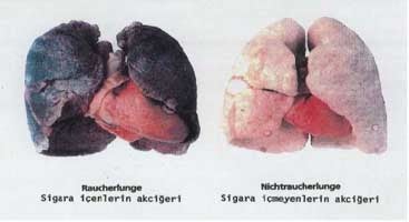 sigaranin akcigere zararlari oku kompozisyon ornekleri
