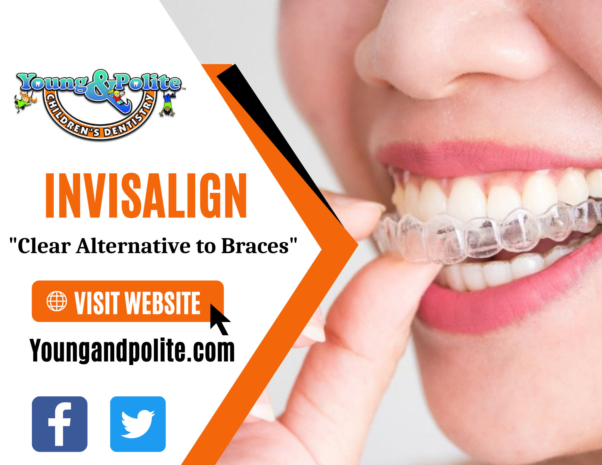 Complete Invisalign treatment