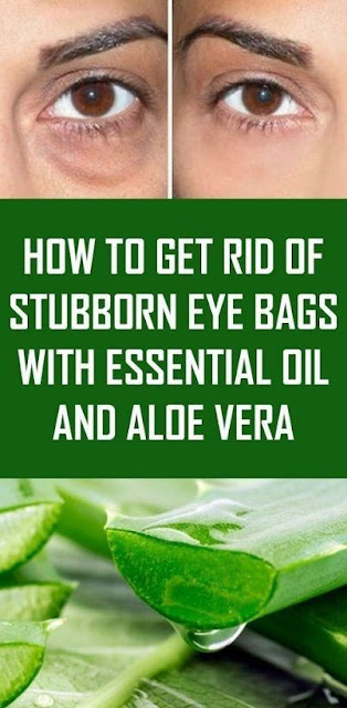 Aloe Vera and Essential Oil to Remove the Stubborn Eye Bags!